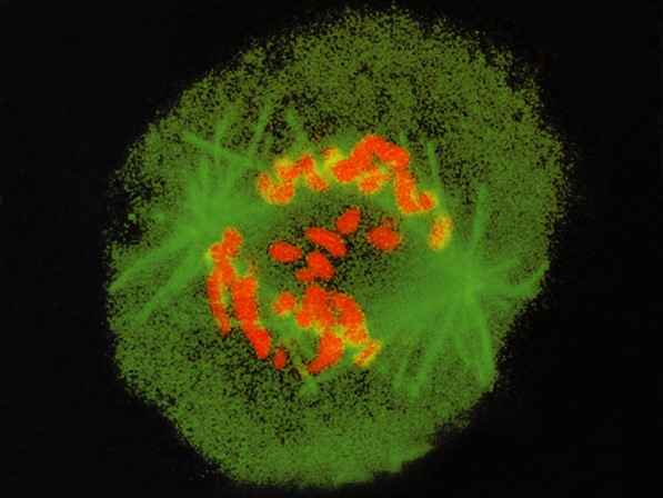 がん細胞 －微小管からのアプローチ－
